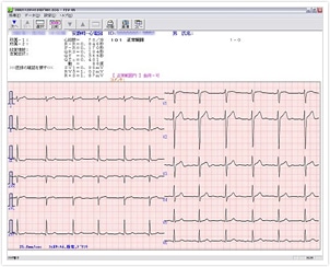 フクダ電子社のビューアFEV-05による心電図表示